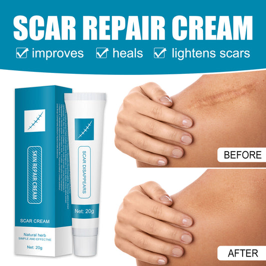 Scar Cream Scar Removal Cream for Stretch Marks Acnes Spots Burns and Surgical Scars Face and Body Skin Scar Reduce & Repair