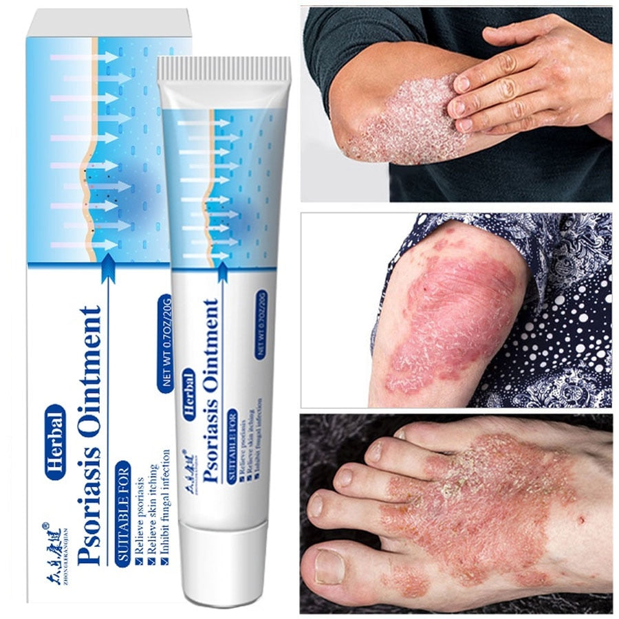 Antibacterial Psoriasis Cream Herbal Effective Anti-itch Relief Dermatitis Eczema Treatment Urticaria Desquamation Skin Care 20g