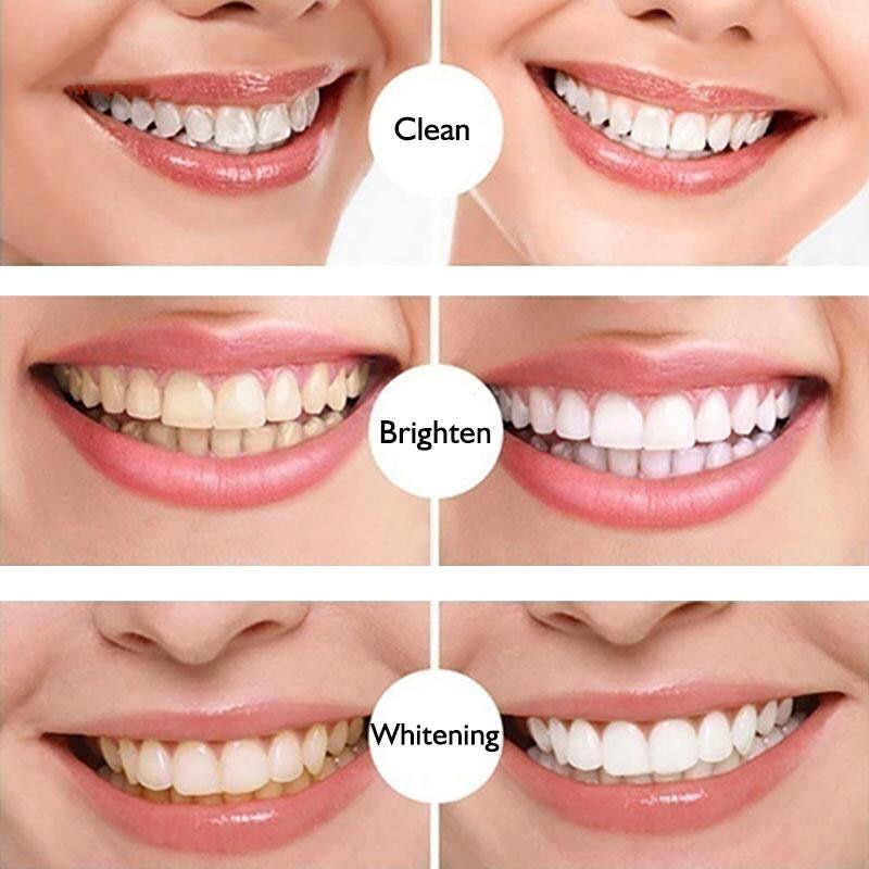 Teeth Whitening Pen Tooth Gel Whitener Bleach Remove Stains Oral Hygiene Cleaning Gel Fresh Breath Whiten Teeth Cleaning Serum