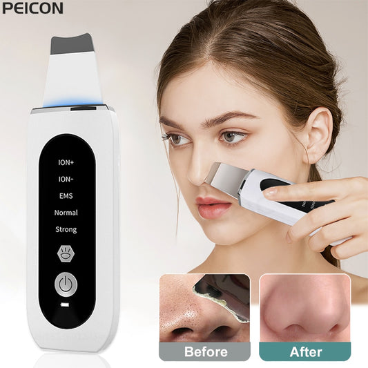 Ultrasonic Skin Scrubber Peeling Blackhead Remover Deep Face Cleaning Ultrasonic Ion Ance Pore Cleaner Facial Shovel Cleanser