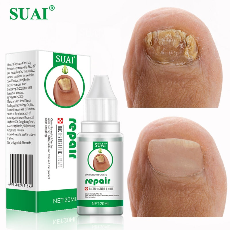 SUAI Nail Fungal Treatment Feet Care Essence Foot Repair Nail Fungus Removal Serum Gel Anti Infection Paronychia Onychomycosis